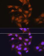 RPSA Polyclonal Antibody
