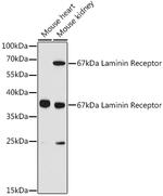 RPSA Antibody in Western Blot (WB)