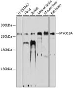 MYO18A Polyclonal Antibody
