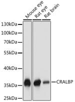 CRALBP Polyclonal Antibody