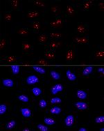 EBNA1BP2 Polyclonal Antibody