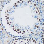 PSPC1 Antibody in Immunohistochemistry (Paraffin) (IHC (P))