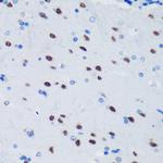 PSPC1 Antibody in Immunohistochemistry (Paraffin) (IHC (P))