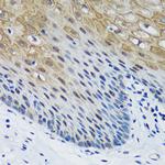 PSPC1 Polyclonal Antibody