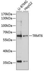 TRMT6 Polyclonal Antibody