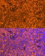 FAM65B Polyclonal Antibody