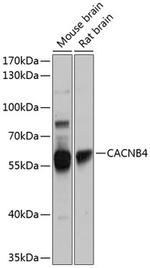 Calcium Channel beta-4 Polyclonal Antibody