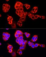 SEC31A Polyclonal Antibody