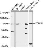 KCNN1 Polyclonal Antibody