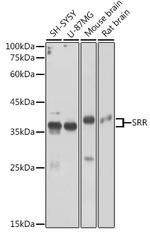 Serine racemase Polyclonal Antibody