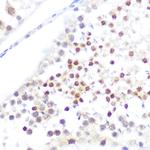 NUP50 Polyclonal Antibody