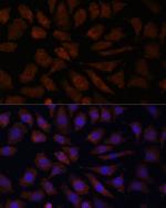 OAS3 Antibody in Immunocytochemistry (ICC/IF)