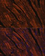 MYH6 Antibody in Immunohistochemistry (IHC)