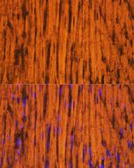 MYH6 Antibody in Immunohistochemistry (IHC)