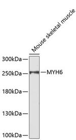 MYH6 Antibody in Western Blot (WB)
