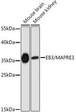 MAPRE3 Polyclonal Antibody