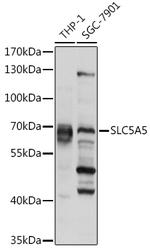 SLC5A5 Polyclonal Antibody