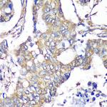 TXNDC9 Polyclonal Antibody