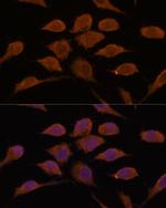 USP19 Antibody in Immunocytochemistry (ICC/IF)