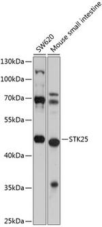 STK25 Polyclonal Antibody