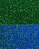 NOXA Polyclonal Antibody