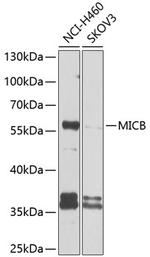 MICB Polyclonal Antibody