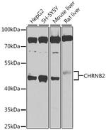 CHRNB2 Polyclonal Antibody