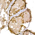 CTAG1B Polyclonal Antibody