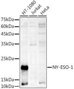 CTAG1B Antibody in Western Blot (WB)