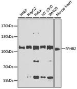 EphB2 Polyclonal Antibody