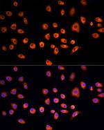 EPS15 Antibody in Immunocytochemistry (ICC/IF)