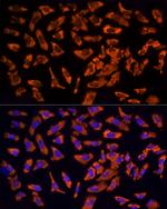 EPS15 Polyclonal Antibody