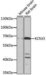 Kir3.1 (KCNJ3) Polyclonal Antibody