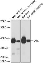 OTC Polyclonal Antibody