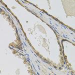 PTK7 Polyclonal Antibody