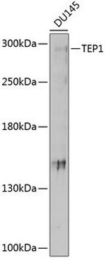 TEP1 Polyclonal Antibody