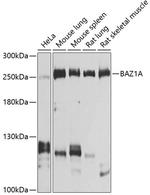 BAZ1A Polyclonal Antibody