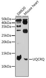 UQCRQ Polyclonal Antibody