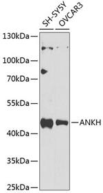 ANKH Polyclonal Antibody