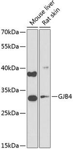 Connexin 30.3 Polyclonal Antibody