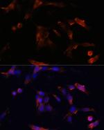 Aquaporin 5 Polyclonal Antibody