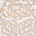 KIR3DS1 Antibody in Immunohistochemistry (Paraffin) (IHC (P))