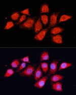 PDHA2 Antibody in Immunocytochemistry (ICC/IF)