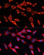 PDHA2 Polyclonal Antibody