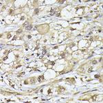 PSMB3 Polyclonal Antibody