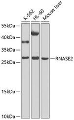 RNASE2 Antibody in Western Blot (WB)