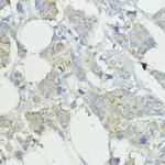 SOCS6 Polyclonal Antibody