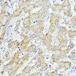 SOCS6 Antibody in Immunohistochemistry (Paraffin) (IHC (P))