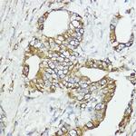 SOCS6 Antibody in Immunohistochemistry (Paraffin) (IHC (P))