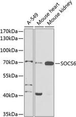 SOCS6 Antibody in Western Blot (WB)